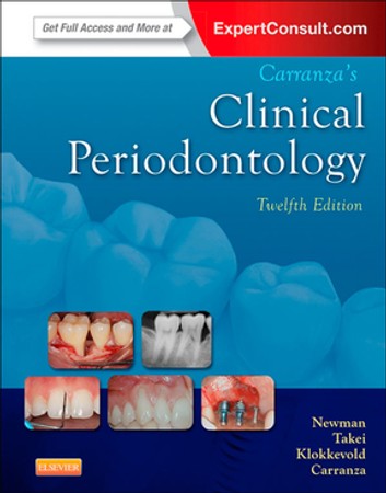 Carranza Periodontology Free Download